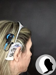 CI Kopf 2018 Erwachsen